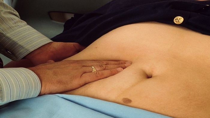 Murphy Sign What Is It Technique Exam Predictive Value And History Scope Heal