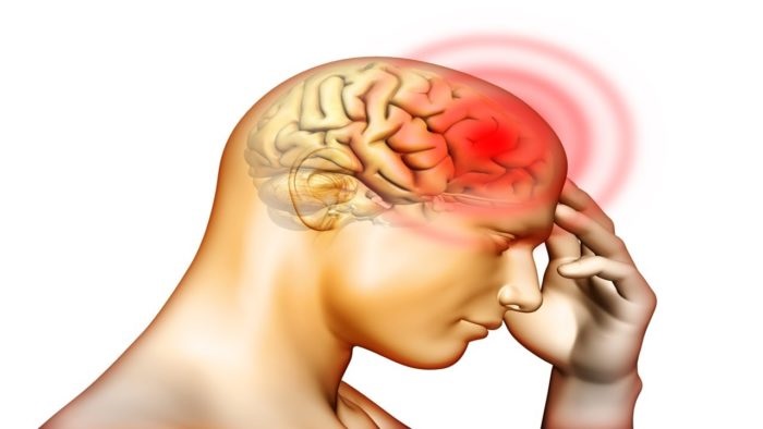 Cerebral Hemorrhage: What is it? Causes, Symptoms, Diagnosis ...